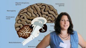 דוקטורנטית סיון גרשנוב, אוני' אריאל' | רקע: Medulloblastoma