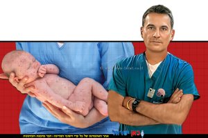 מנהל המערך לטיפול נמרץ ילדים ב-מרכז הרפואי הדסה, ד"ר אורי פולק | רקע: פעוט חולה בחצבת | צילום babyology-com-au לייעוץ הורות | יחצ | עיבוד: Photolab | עיבוד צילום: שולי סונגו©