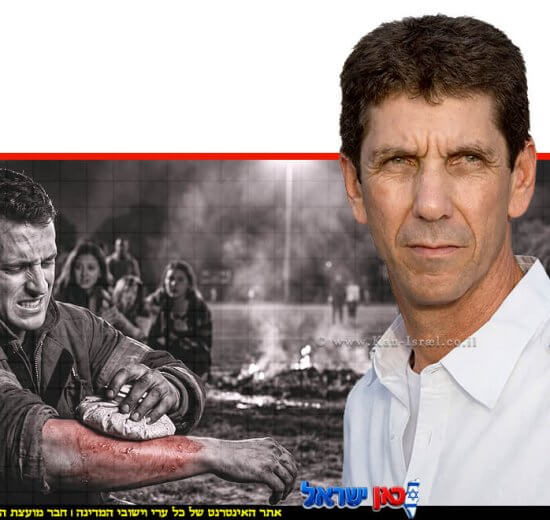 מנכ"ל מד"א, רמ"ג אלי בין ברקע, הדמייה: איש נכווה כתוצאה ממדורת ל"ג בעומר | צילום: ai | עיצוב: שולי סונגו©