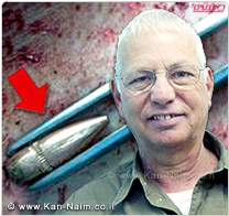 המרכז הרפואי זיו, צפת: רופאים, נאבקו על חיי נער בן 16, שפלט כדור לעבר חזהו
