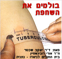 בולמים את השחפת